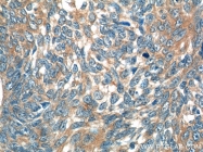 24402-1-AP - Interleukin-19 / IL19