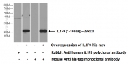 21255-1-AP - IL1F9 / IL1H1