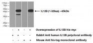 17645-1-AP - Interleukin-12 beta / IL12B
