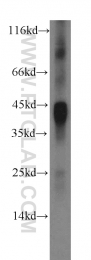17645-1-AP - Interleukin-12 beta / IL12B