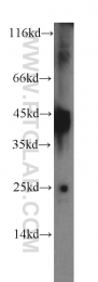 17645-1-AP - Interleukin-12 beta / IL12B