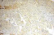 16744-1-AP - IL15RA
