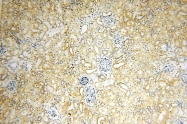 16744-1-AP - IL15RA