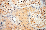 16744-1-AP - IL15RA