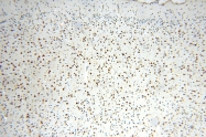 16744-1-AP - IL15RA