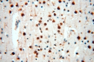 16744-1-AP - IL15RA