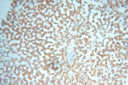 16744-1-AP - IL15RA