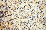 16744-1-AP - IL15RA