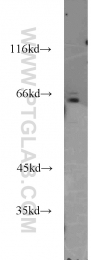 16744-1-AP - IL15RA