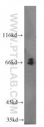 16744-1-AP - IL15RA