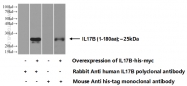 24495-1-AP - Interleukin-17B / IL17B