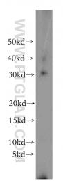16765-1-AP - Interleukin-1 alpha / IL-1A