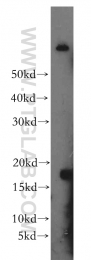16765-1-AP - Interleukin-1 alpha / IL-1A