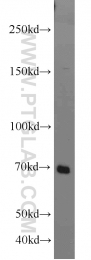 10533-1-AP - Interleukin-21 receptor / IL21R