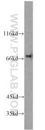 10533-1-AP - Interleukin-21 receptor / IL21R