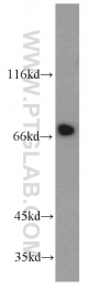 10533-1-AP - Interleukin-21 receptor / IL21R