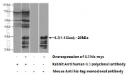 17835-1-AP - Interleukin-3 / IL3