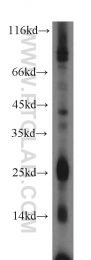17835-1-AP - Interleukin-3 / IL3