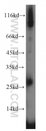 17835-1-AP - Interleukin-3 / IL3