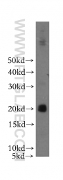 17835-1-AP - Interleukin-3 / IL3