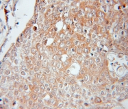 11079-1-AP - Interleukin-32 / IL32