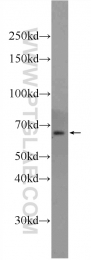 24738-1-AP - ILVBL / AHAS