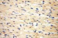 17797-1-AP - INPP5E