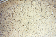 17797-1-AP - INPP5E