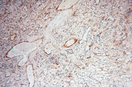 17797-1-AP - INPP5E