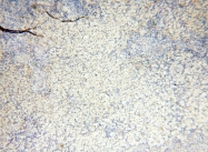 17797-1-AP - INPP5E