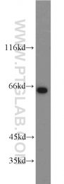 17797-1-AP - INPP5E