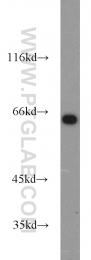 17797-1-AP - INPP5E