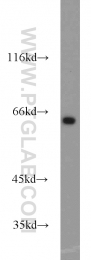 17797-1-AP - INPP5E