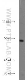 17797-1-AP - INPP5E