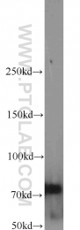 11657-1-AP - INTS9 / RC74