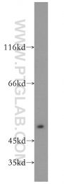 11657-1-AP - INTS9 / RC74