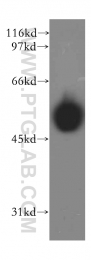 13155-1-AP - InsP6 kinase 2 / IP6K2