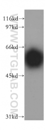 13155-1-AP - InsP6 kinase 2 / IP6K2