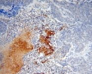 14403-1-AP - RanBP11 / Importin-11