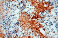 14403-1-AP - RanBP11 / Importin-11