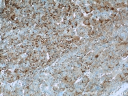 22167-1-AP - IQGAP1