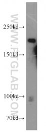 22167-1-AP - IQGAP1