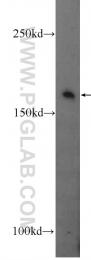 25930-1-AP - IQGAP3
