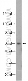 11335-1-AP - IRF1