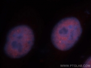 13698-1-AP - IRF2BP1