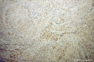 13698-1-AP - IRF2BP1