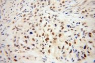 13698-1-AP - IRF2BP1