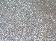 22392-1-AP - IRF7