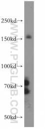 17509-1-AP - IRS1
