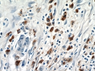 15981-1-AP - ISG15 / G1P2